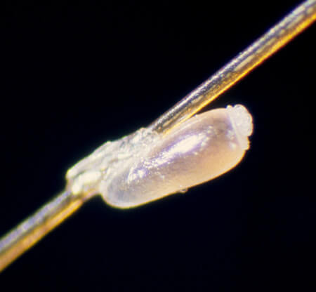 Image of head lice egg. 