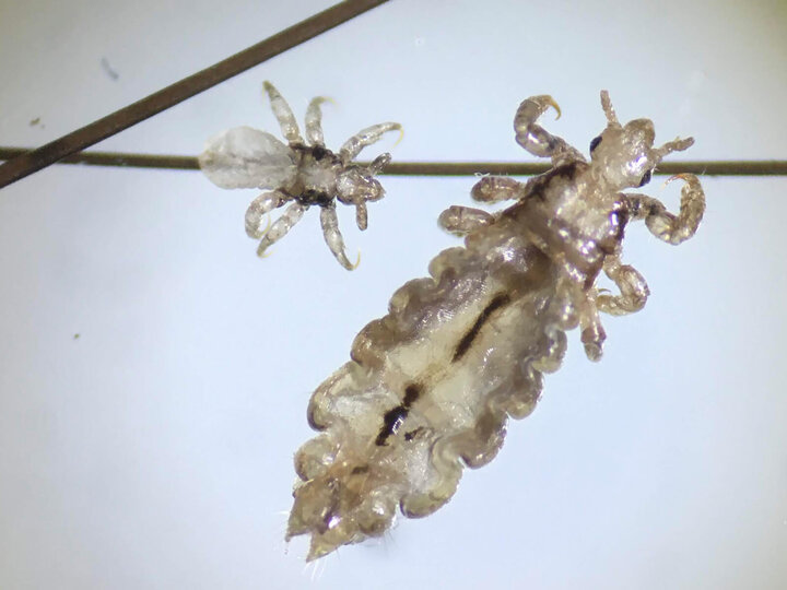 Image of head lice adult and immature nit. 